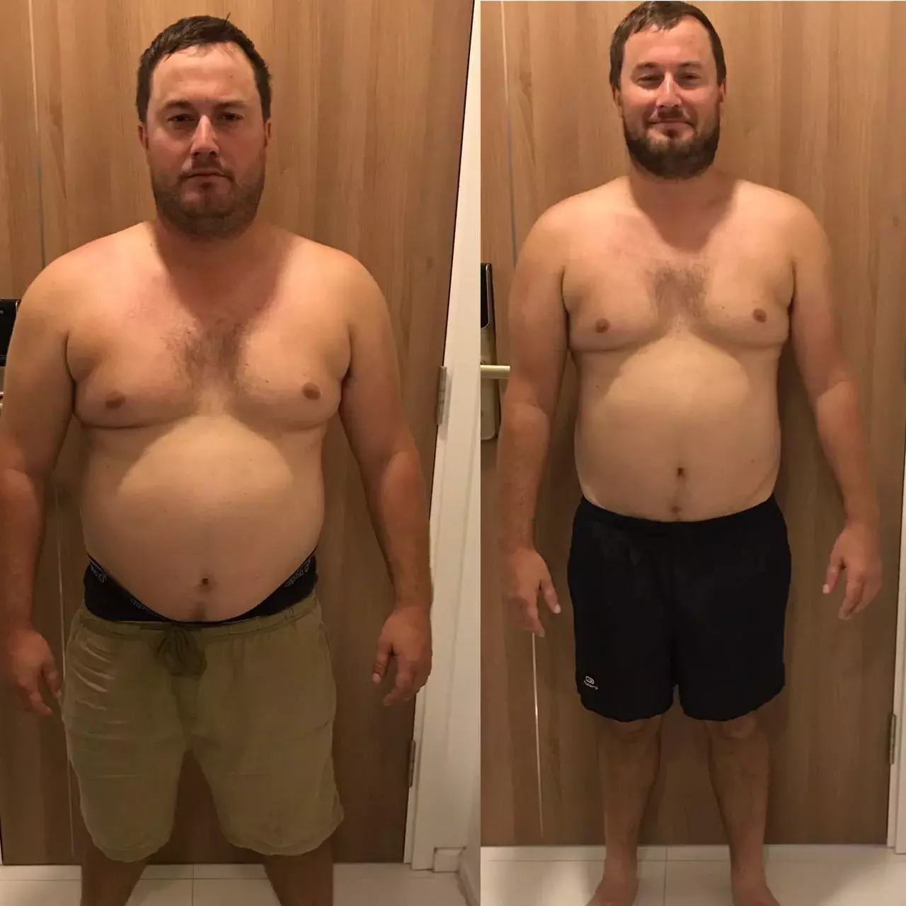 Paul Carter before and after