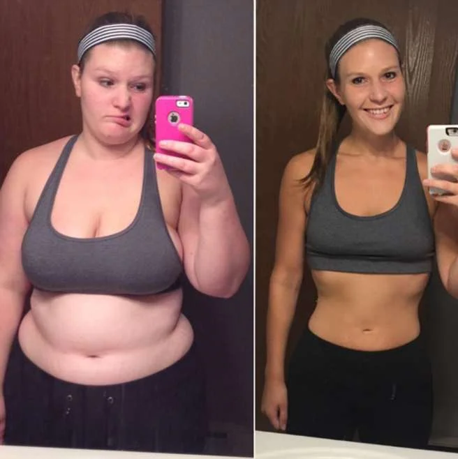 Anne T. before and after